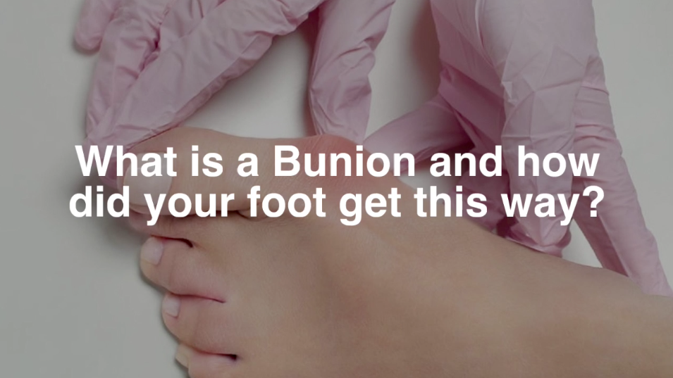 https://tayton.com/assets/bunion_treatment_poster.png